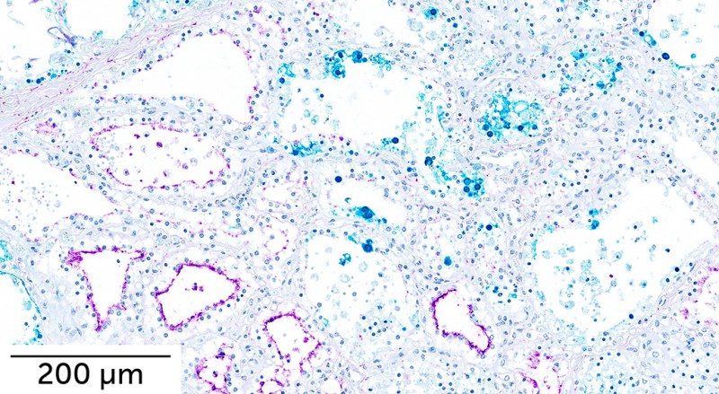 Blue and purple dots are scattered around a microscopic image of cow mammary gland cells infected with bird flu